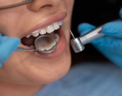 Procedimentos de dentística estética em clínica odontológica em Osasco SP