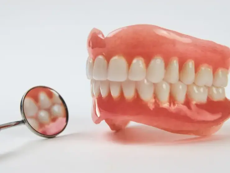 Prótese dentária fixa sobre implantes