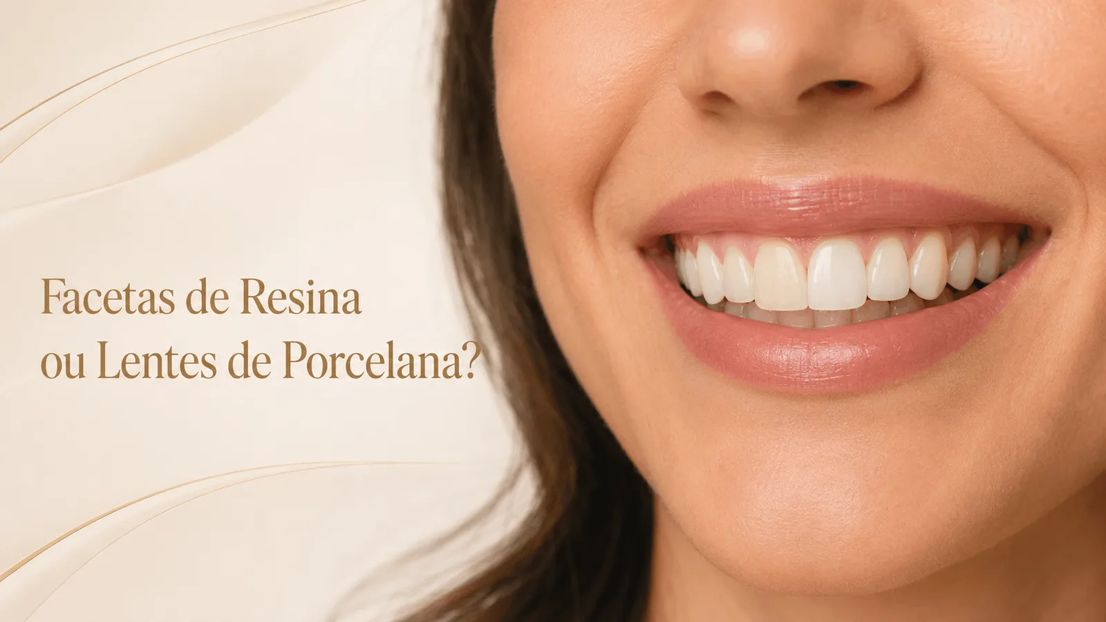 Facetas de Resina ou lentes de Porcelana: Qual é a melhor opção para o seu sorriso?