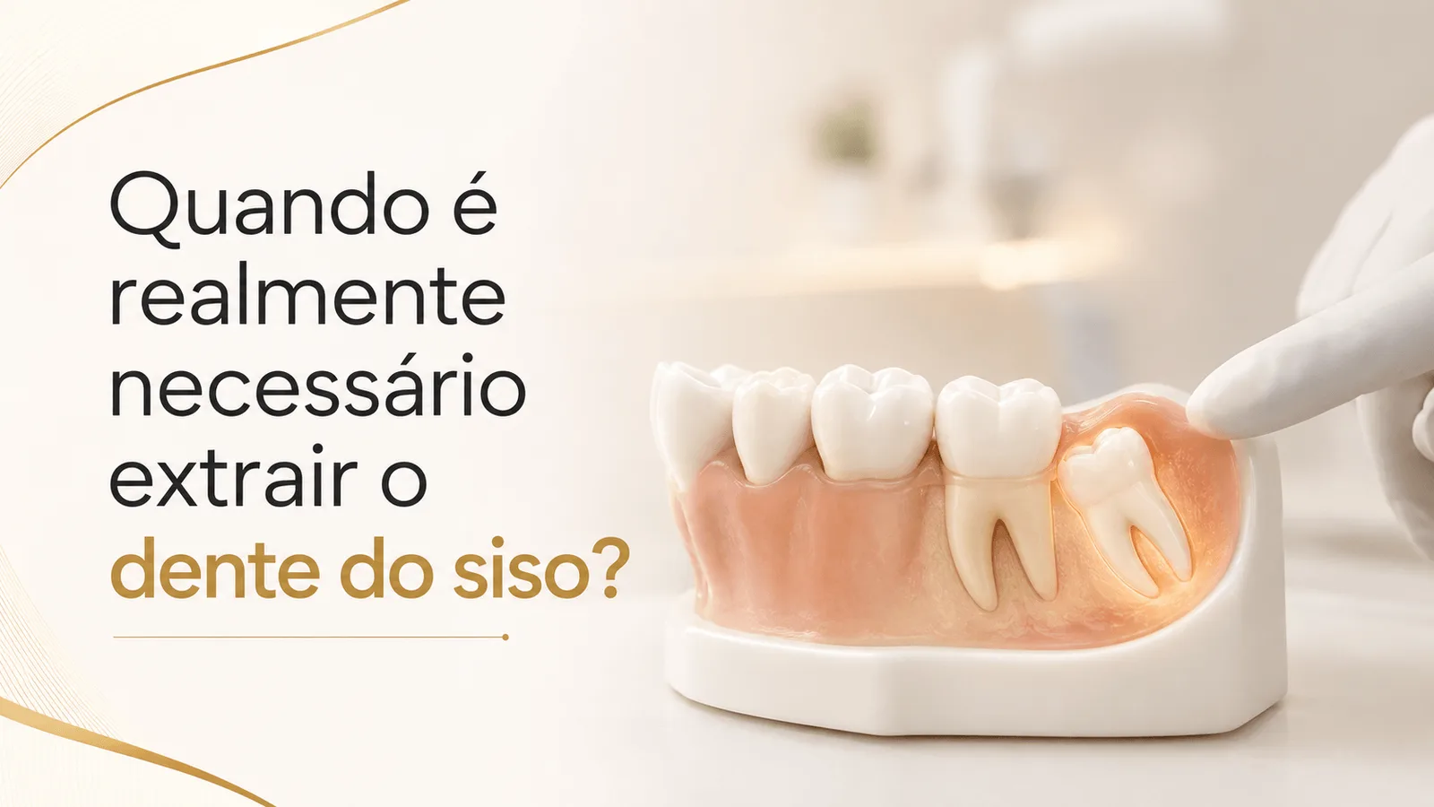 Quando é realmente necessário extrair o dente do siso?