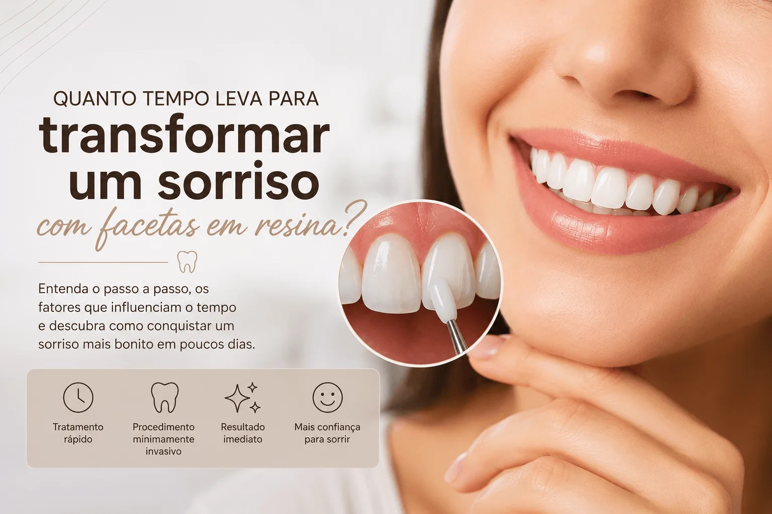 Quanto tempo leva para transformar um sorriso com facetas em resina? Descubra em quanto tempo é possível conquistar um sorriso mais bonito e natural