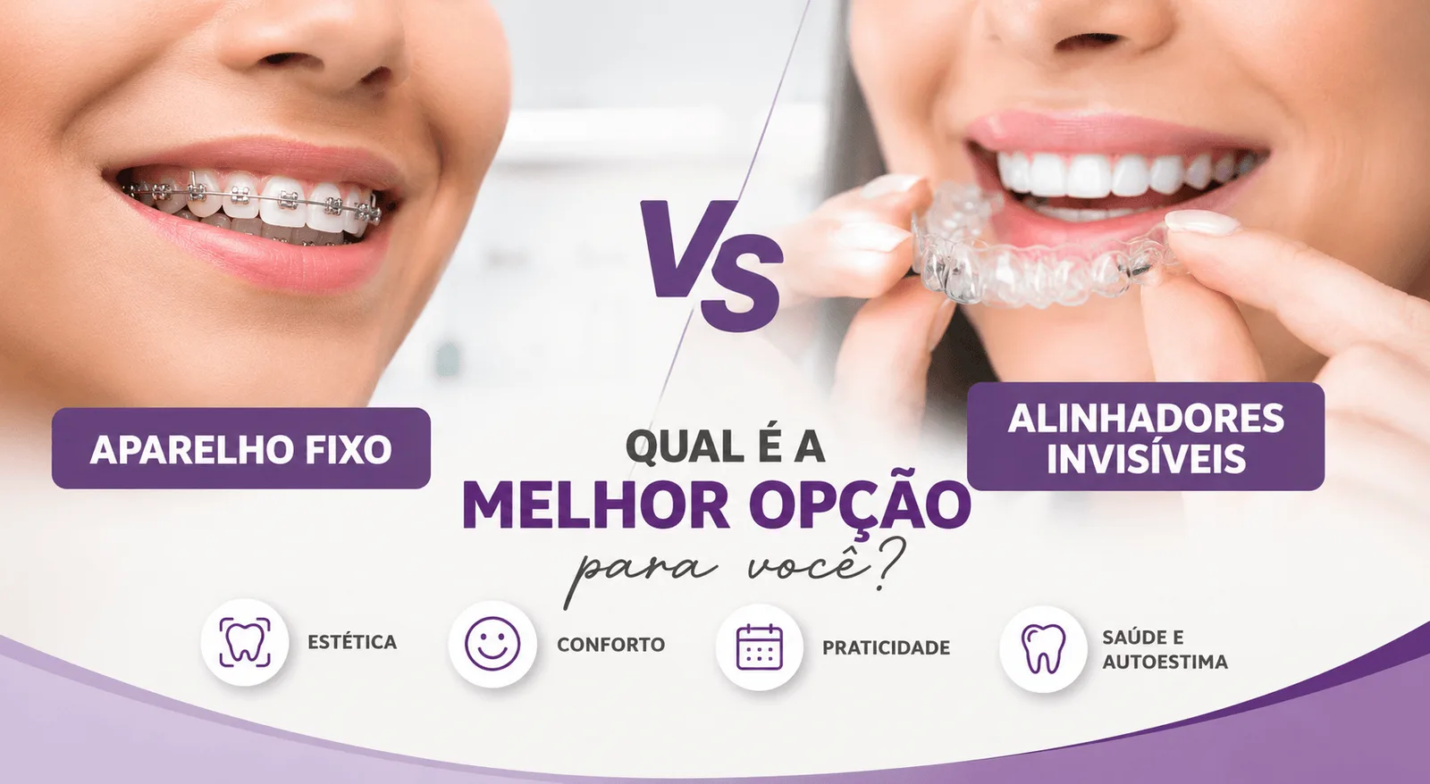 Aparelho Fixo ou Alinhadores Invisíveis: Qual é a Melhor Opção para Você?