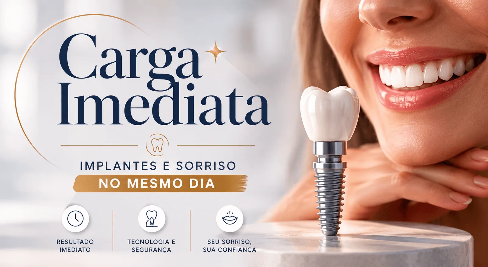 Carga Imediata: Coloque implantes dentários e saia sorrindo no mesmo dia
