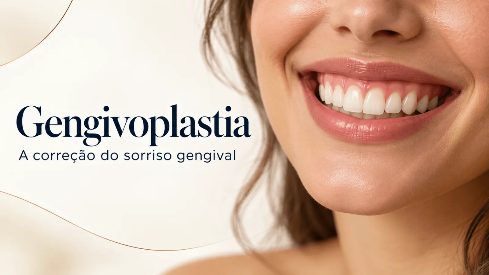 Sorriso com exposição gengival, ilustrando o tema gengivoplastia.