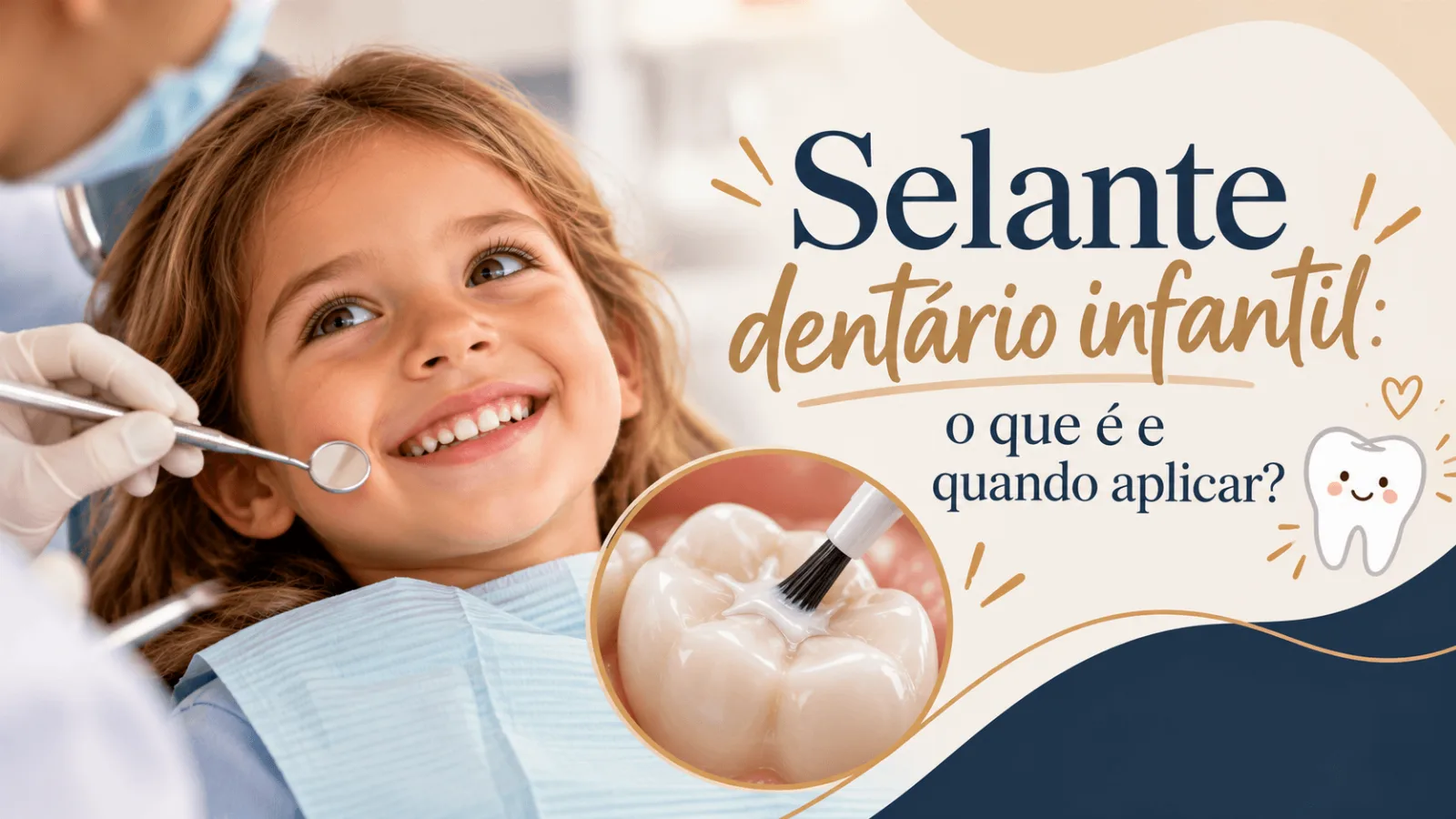 Selante dentário infantil aplicado nos molares para ajudar a prevenir cáries e proteger os dentes das crianças durante a infância.
