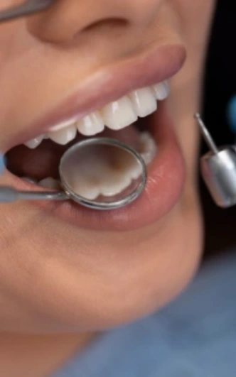 Procedimentos de dentística estética em clínica odontológica em Osasco SP