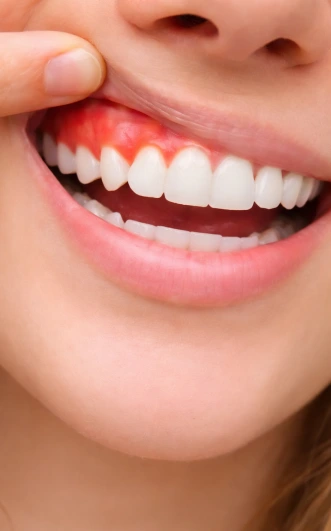 Tratamentos de periodontia e endodontia em clínica odontológica em Osasco SP